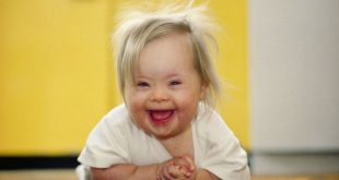 В Плевен започват записвания за безплатни консултации за деца със синдром на Даун и техните родители